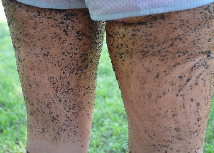 celulitis en las piernas hombres